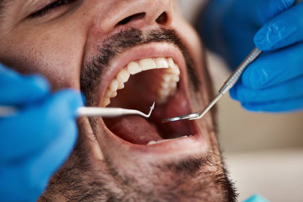 Best Tooth Infection Emergency Dentist  in Tuckerton, NJ
